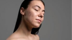 Kesalahan Skincare yang Bikin Kulit Kering Semakin Parah