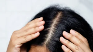 Scalp Scrub: