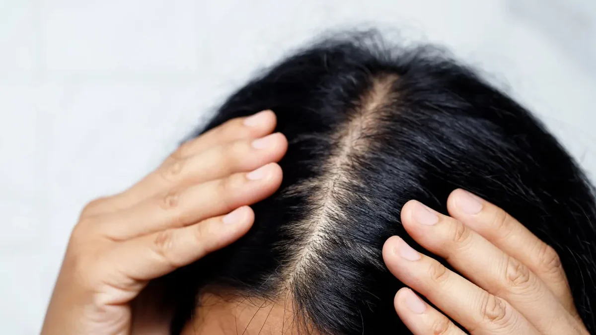 Scalp Scrub: Cara Membersihkan Kulit Kepala agar Rambut Sehat